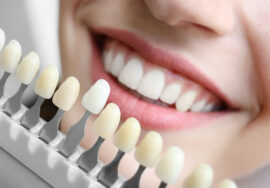 Young woman choosing color of teeth